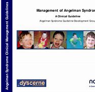 Image result for Clinical Angelman Syndrome