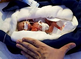 Image result for Tiniest Baby