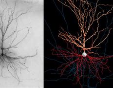 Image result for Real Neuron Cell