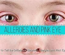Image result for Makeup Allergy