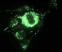 Image result for Bone Cells at 100X