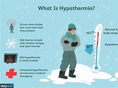 Image result for hypothermia