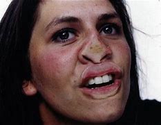 Image result for Squashed Face