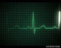 Image result for Arm Hart Monitor