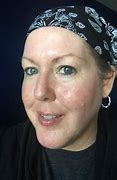 Image result for Chemo Cream for Face