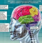 Image result for Emotions and the Brain