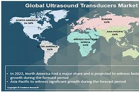 Image result for Ultrasound Market Share