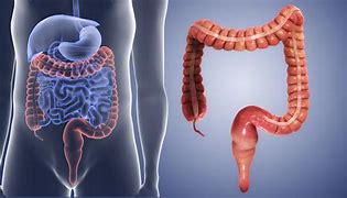 Image result for Intestines Coming Out of Stomach