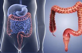 Image result for intestino