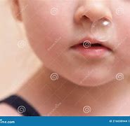 Image result for Baby Crying Snot Bubble