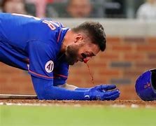 Image result for Baseball Bat to the Face