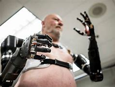 Image result for Robot Arm Prosthesis