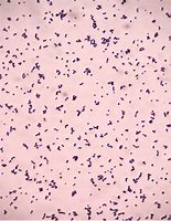 Image result for Gram Stain Positive Cocci
