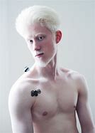 Image result for Albino Pepe