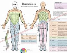 Image result for Nerve Dermatome Chart