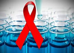 Image result for Aids Cure