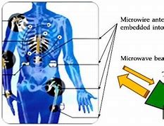 Image result for Microwave Pain Beam