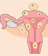 Image result for Uterine Fibroid Uterus Size Chart