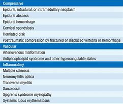 Image result for Disease of Spinal Cord Medications