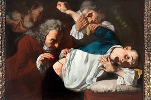 Image result for Surgery in the 18th Century