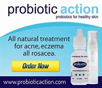 Image result for Probiotics for Rosacea