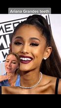 Image result for Ariana Grande Gold Teeth
