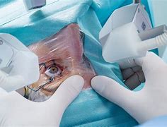 Image result for Eye Surgery