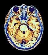 Image result for Brain Scan Memory