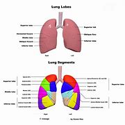 Image result for Lung Nodule 1 8 Cm