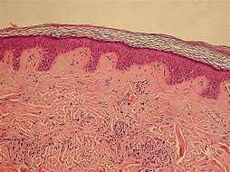 Image result for epidermis