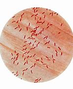 Image result for What Is Simple Stain Technique