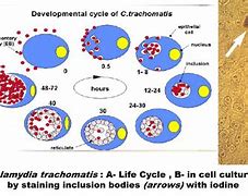 Image result for Chlamydia Gram Stain