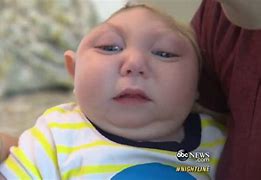 Image result for This Child Is Born with No Brain