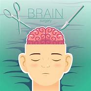 Image result for Brain Surgery Cartoon