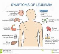Image result for Leukemia Diagram