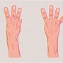 Image result for Mano Gesture