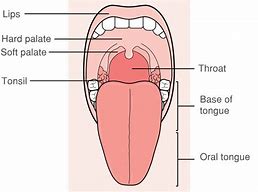 Image result for HPV Side of Tongue