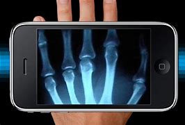 Image result for X-ray for iPhone