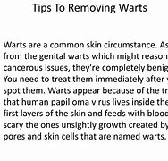 Image result for Wart Removal Surgery
