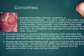 Image result for Gonorrhea Causes
