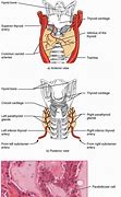Image result for Exercise for Thyroid Patients to Lose Weight