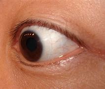 Image result for Contact Lens