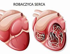 Image result for robaczyca