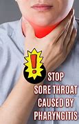 Image result for Throat Warts