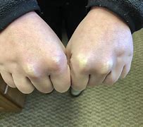 Image result for Hand with No Knuckles