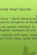 Image result for Kentucky and Tennessee Heart Sounds