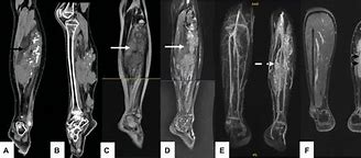 Image result for Gas Leg CT