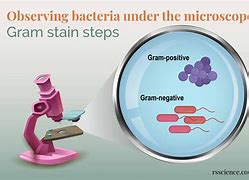 Image result for Gram Stain Process