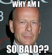 Image result for Going Bald Meme