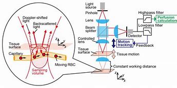 Image result for Laser Doppler Flow Meter